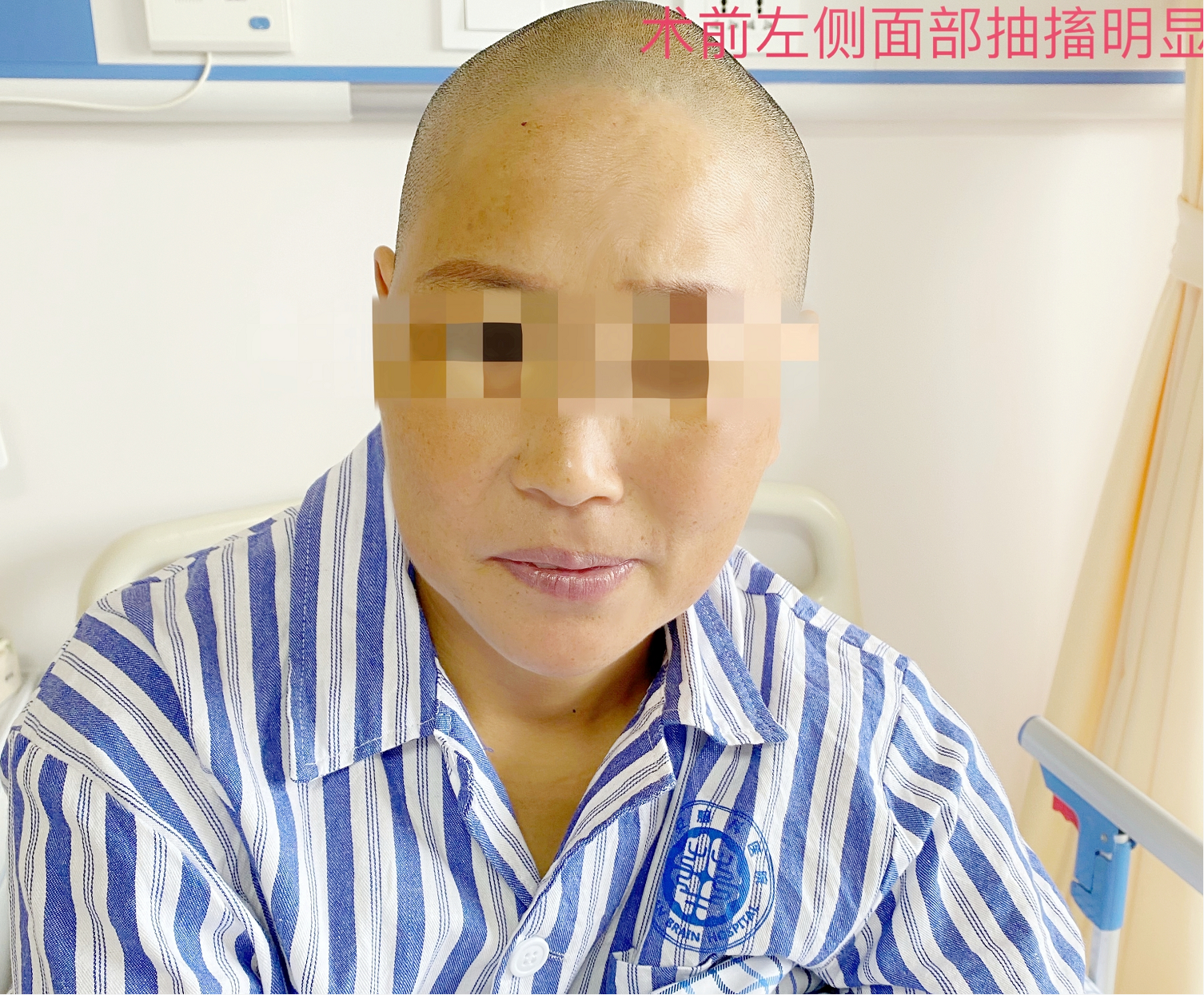 华安脑科医院成功开展首例面肌痉挛显微血管减压术